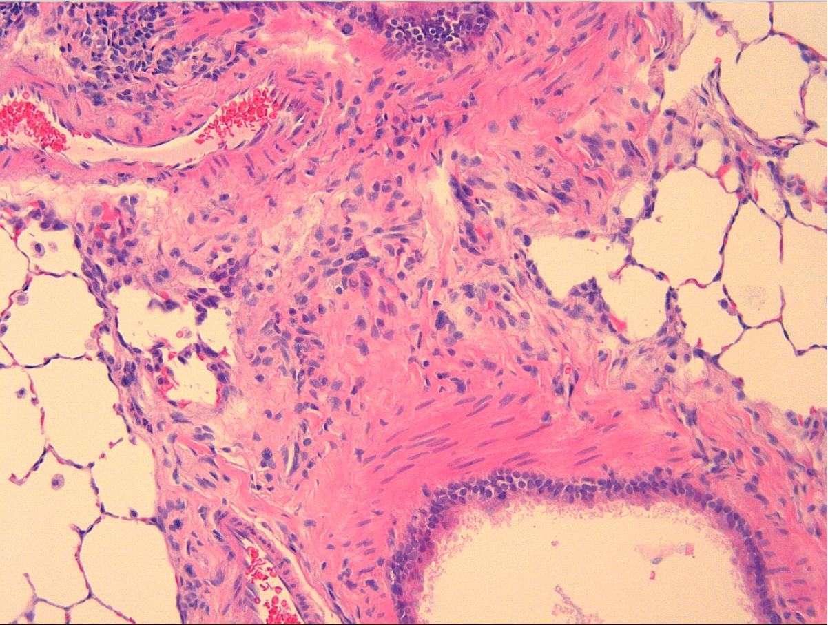 Image of Hematoxylin and eosin staining on a lung tissue