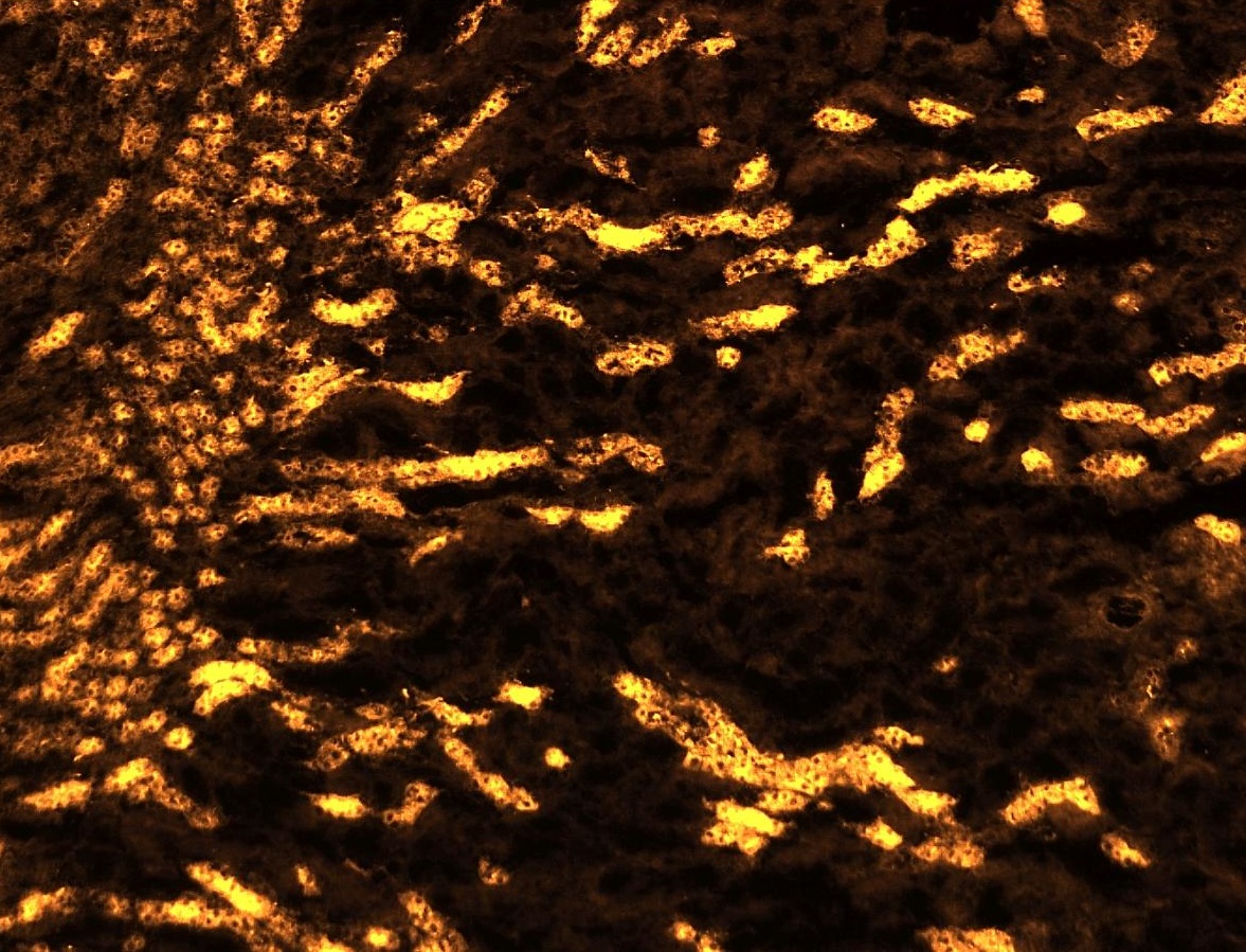 Image of kidney tubules marker stained by IF